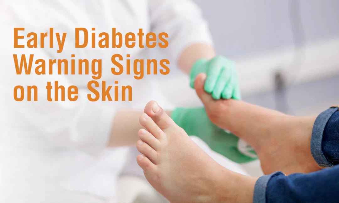Early Diabetes Warning Signs on the Skin