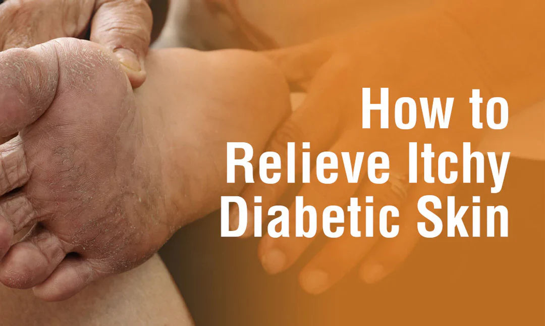 How to Relieve Itchy Diabetic Skin