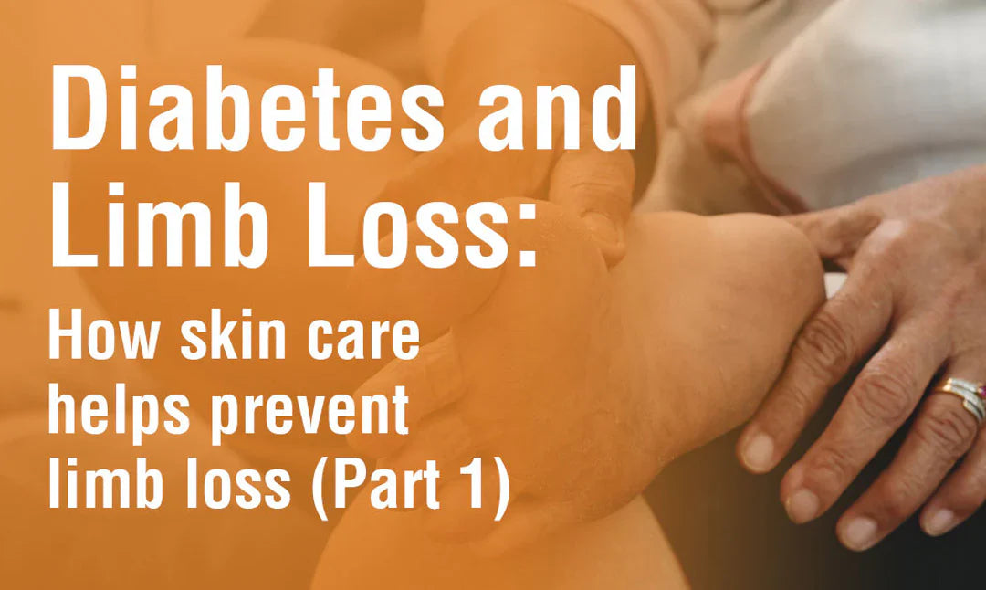 Diabetes and Limb Loss: How Skin Care Helps Prevent Limb Loss (Part 1)