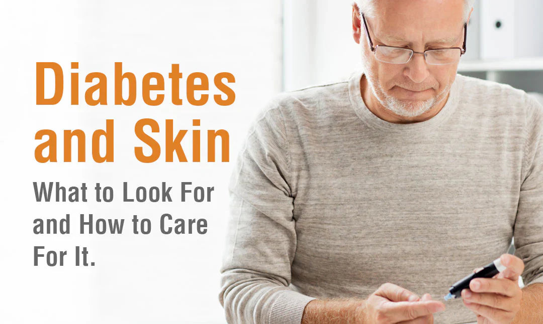Diabetes and Skin - What to Look For and How to Care For It.